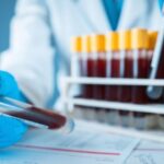Descubren señales en la sangre que podrían anticipar enfermedades intestinales hasta 10 años antes